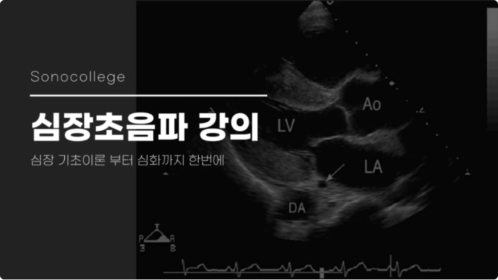 심장 초음파 강의 썸네일