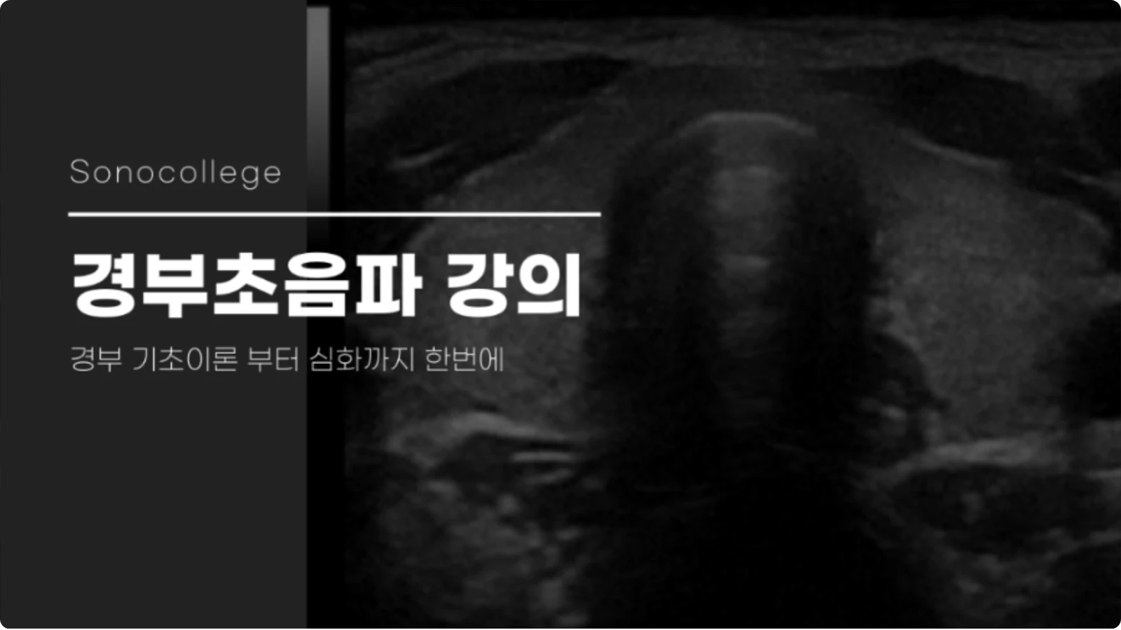 경부 초음파 강의 썸네일