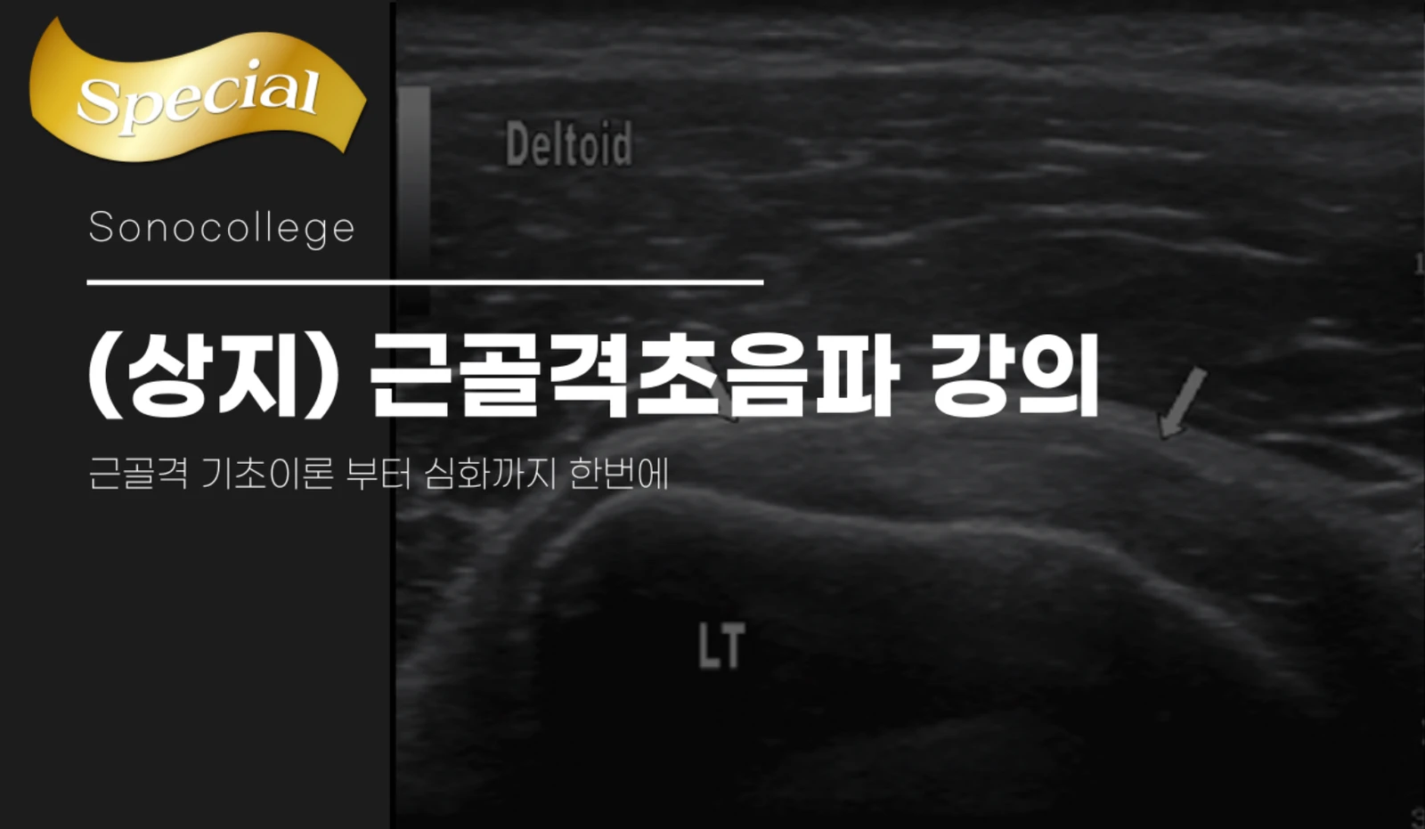 근골격초음파 강의 (상지) 썸네일