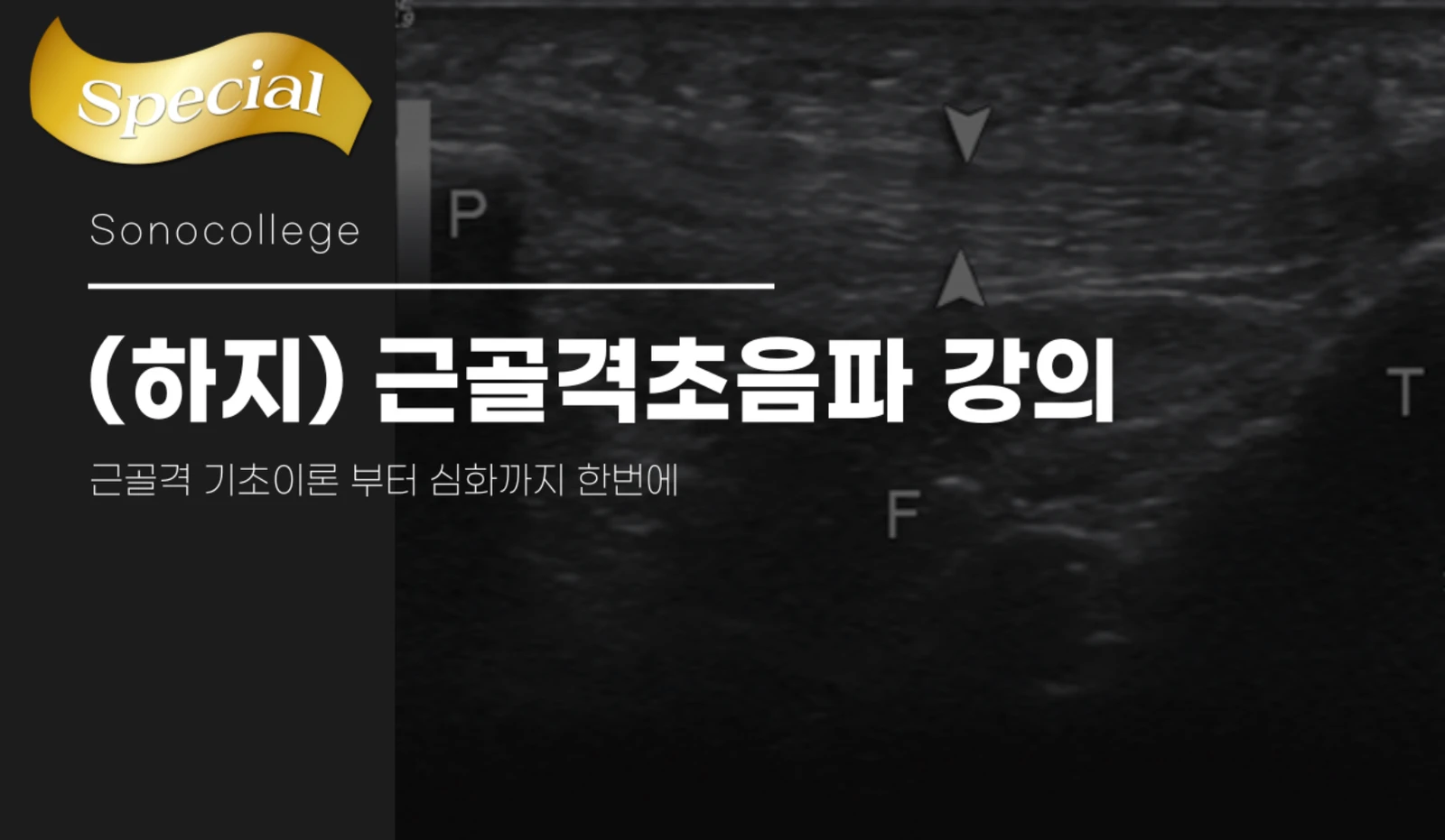 근골격초음파 강의 (하지) 썸네일