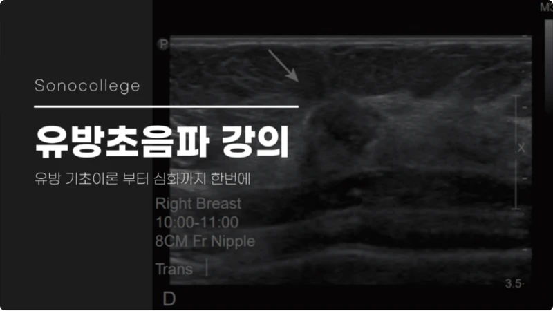 유방 초음파 강의 썸네일