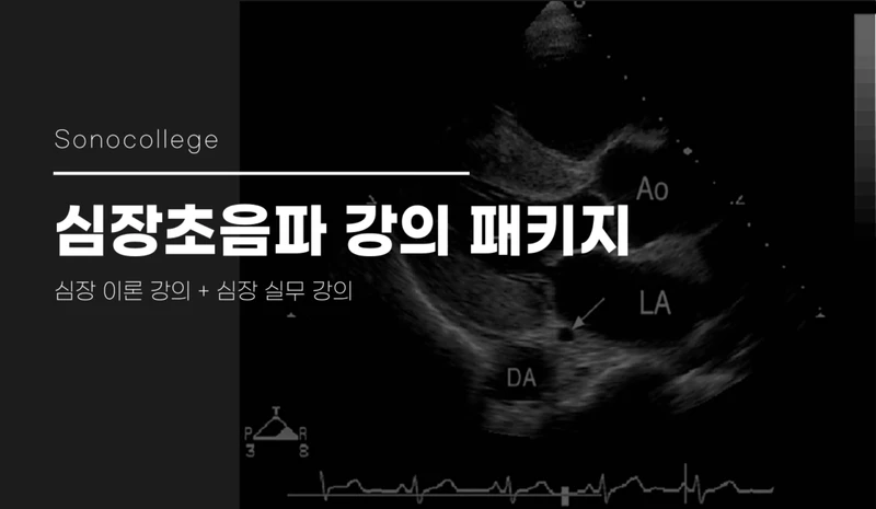 심장초음파 강의 패키지 썸네일
