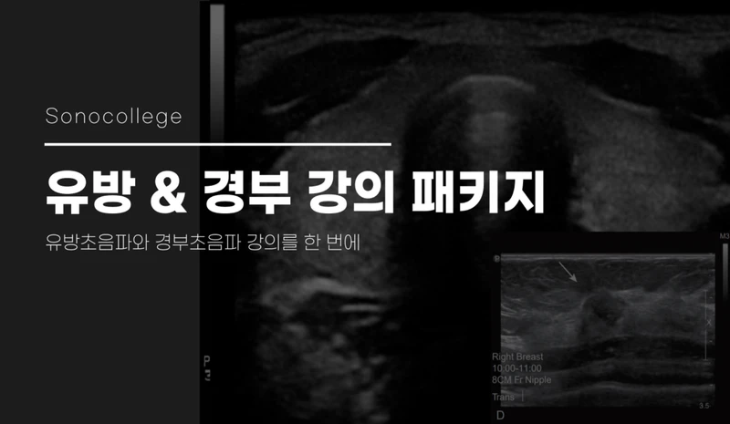유방 & 경부 초음파 패키지 썸네일