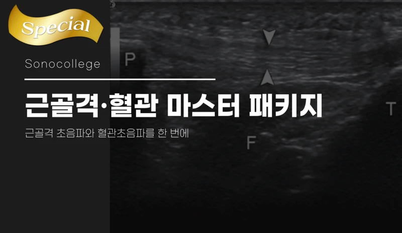근골격·혈관 초음파 마스터 패키지 썸네일