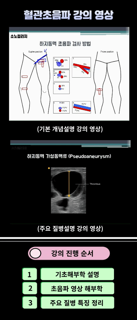 제목을-입력해주세요__복사본.gif