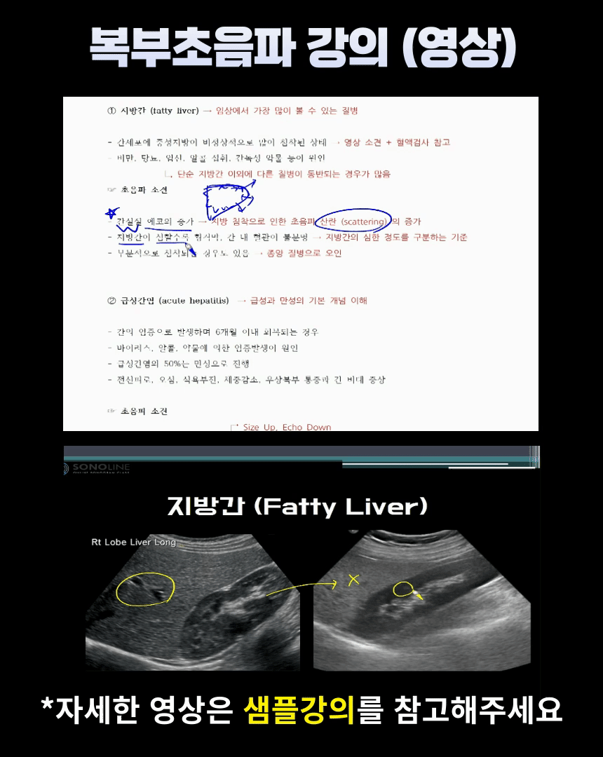 복부수정0.gif